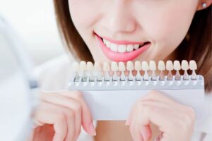Bleaching: Wie Zähne problemlos aufgehellt werden können